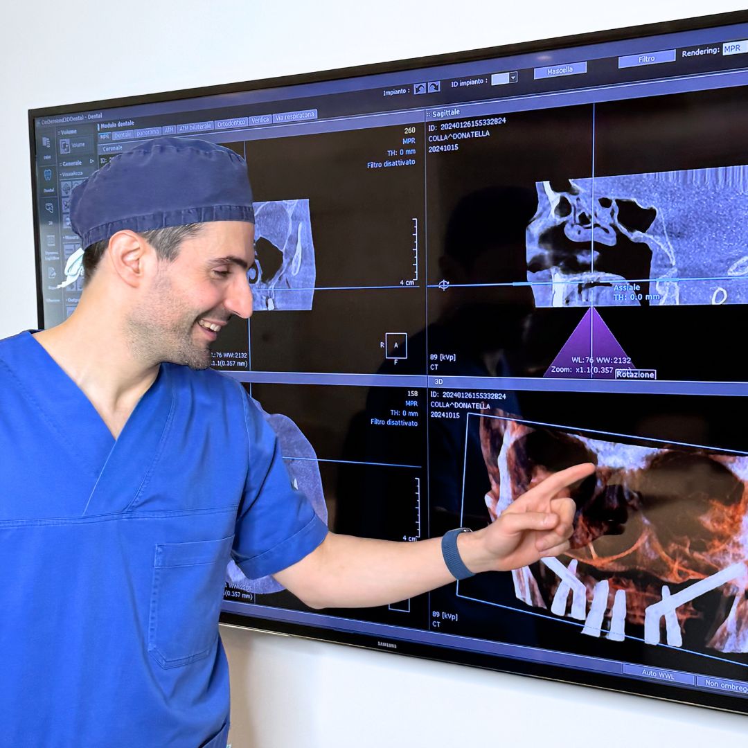 Impianto dentale: tutto quello che devi sapere 4 2. IMPLANTOLOGIA a Brescia - Studio Dentistico Facchinetti - impianto dentale a Brescia - Studio Dentistico Facchinetti: Studio Dentistico a Brescia - Dentista a Brescia