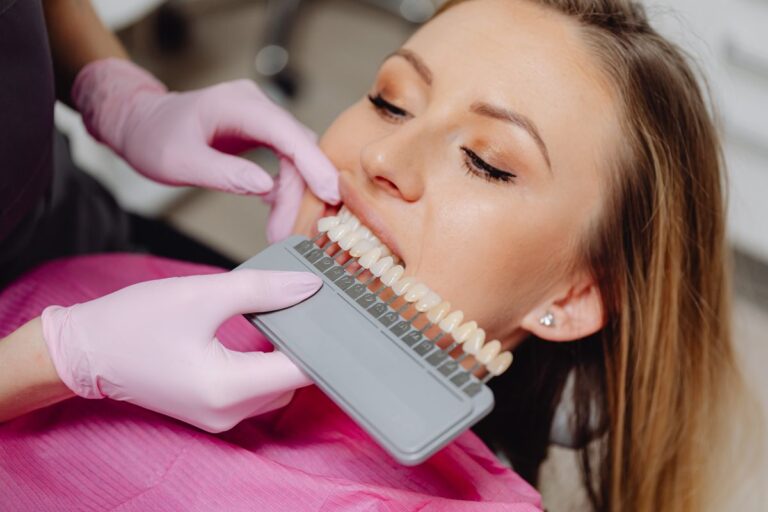 Blog 1 Dentista confronta il colore dei denti con la scala colori per lo sbiancamento