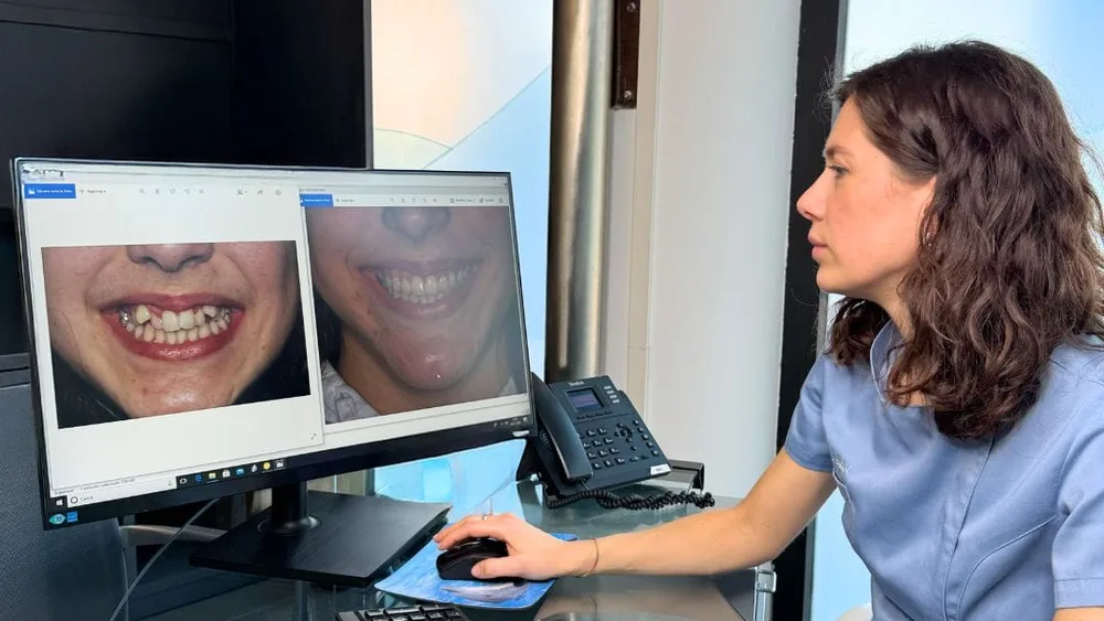 Trattamento di ortodonzia presso Facchinetti Dental