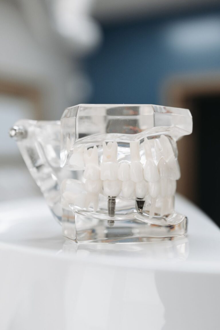 Blog 6 Modello didattico di impianto dentale con vite in titanio