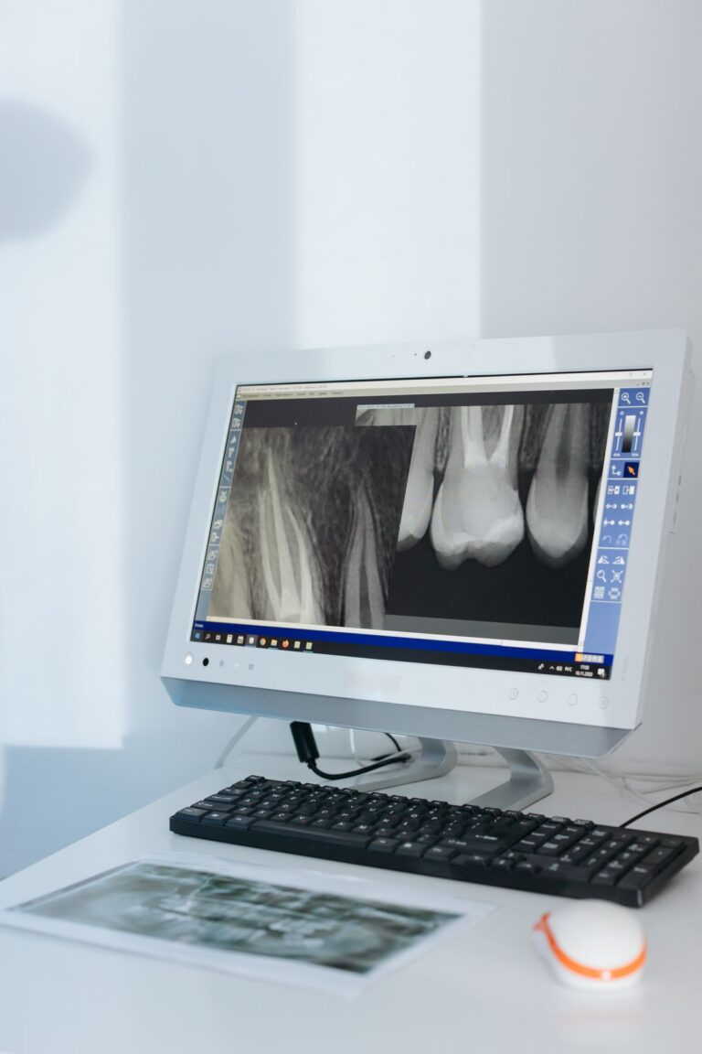 Blog 4 Radiografia digitale su monitor in uno studio dentistico moderno