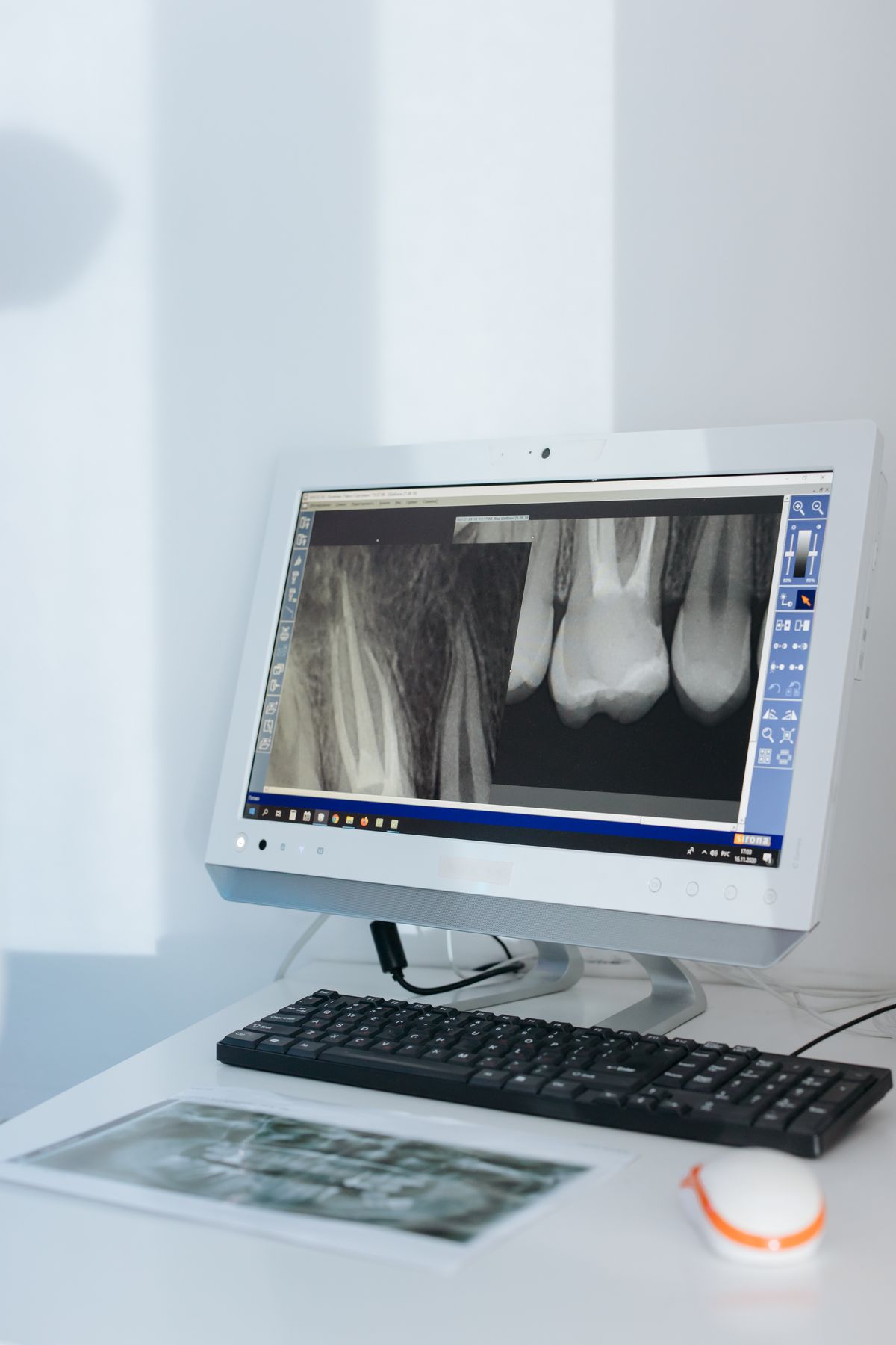 Le Tecnologie dello Studio: Digitale, TAC 3D e Lab Interno 1 Radiografia digitale su monitor in uno studio dentistico moderno